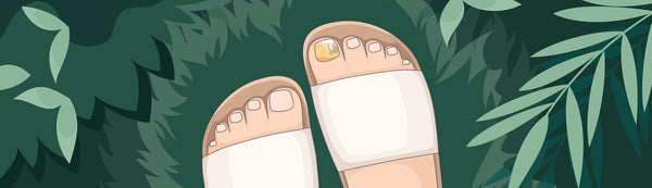 Why Can't I Get Rid Of My Fungal Nail Infection?