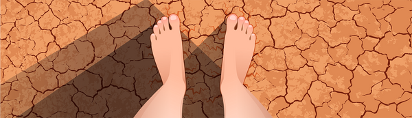 How To Cure Dry Feet & Cracked Heels At Home