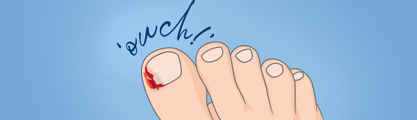 Will My Ingrown Toenail Go Away On Its Own?