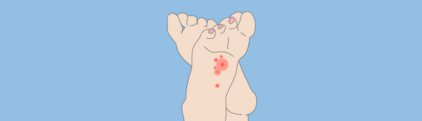 Prevent A Diabetic Foot Ulcer From Home: Podiatrists Guide