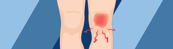 What's Causing My Knee Pain?