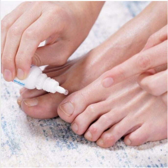 Why Is My Toenail Growing Thick & Discoloured? – merivale-podiatry